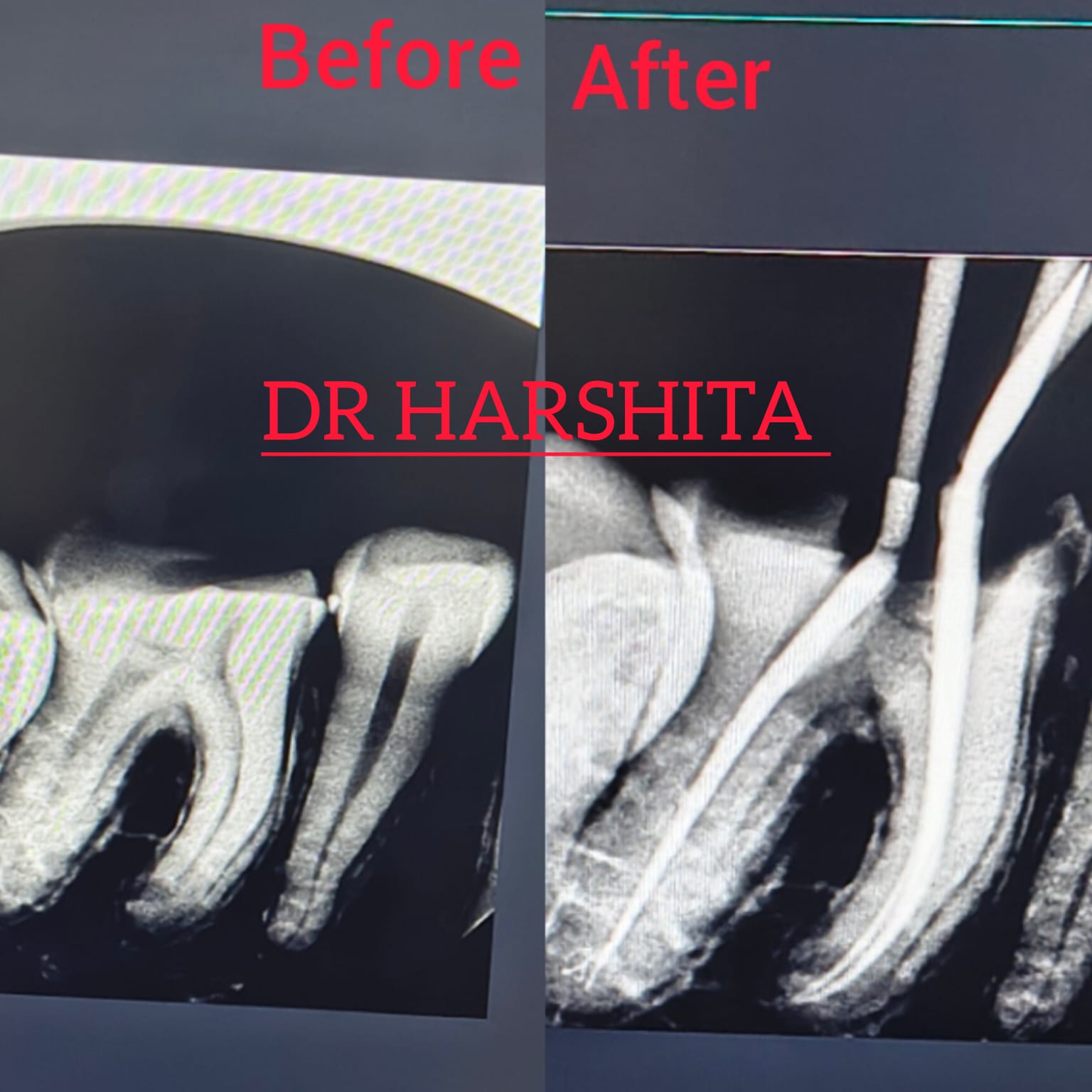 Before & After - Hair Treatment